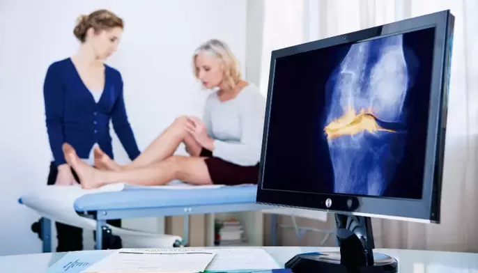 Arthrose des Gelenks bei einer Frau