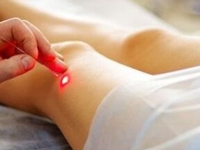 Behandlung der Arthrose des Kniegelenks mit einem Laser